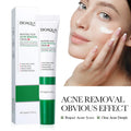 BIOAQUA Salicylic Acid Face Cream Acne Creams Mark Repair Firming Moisturizing Blackhead Remover skincare Facial Cream